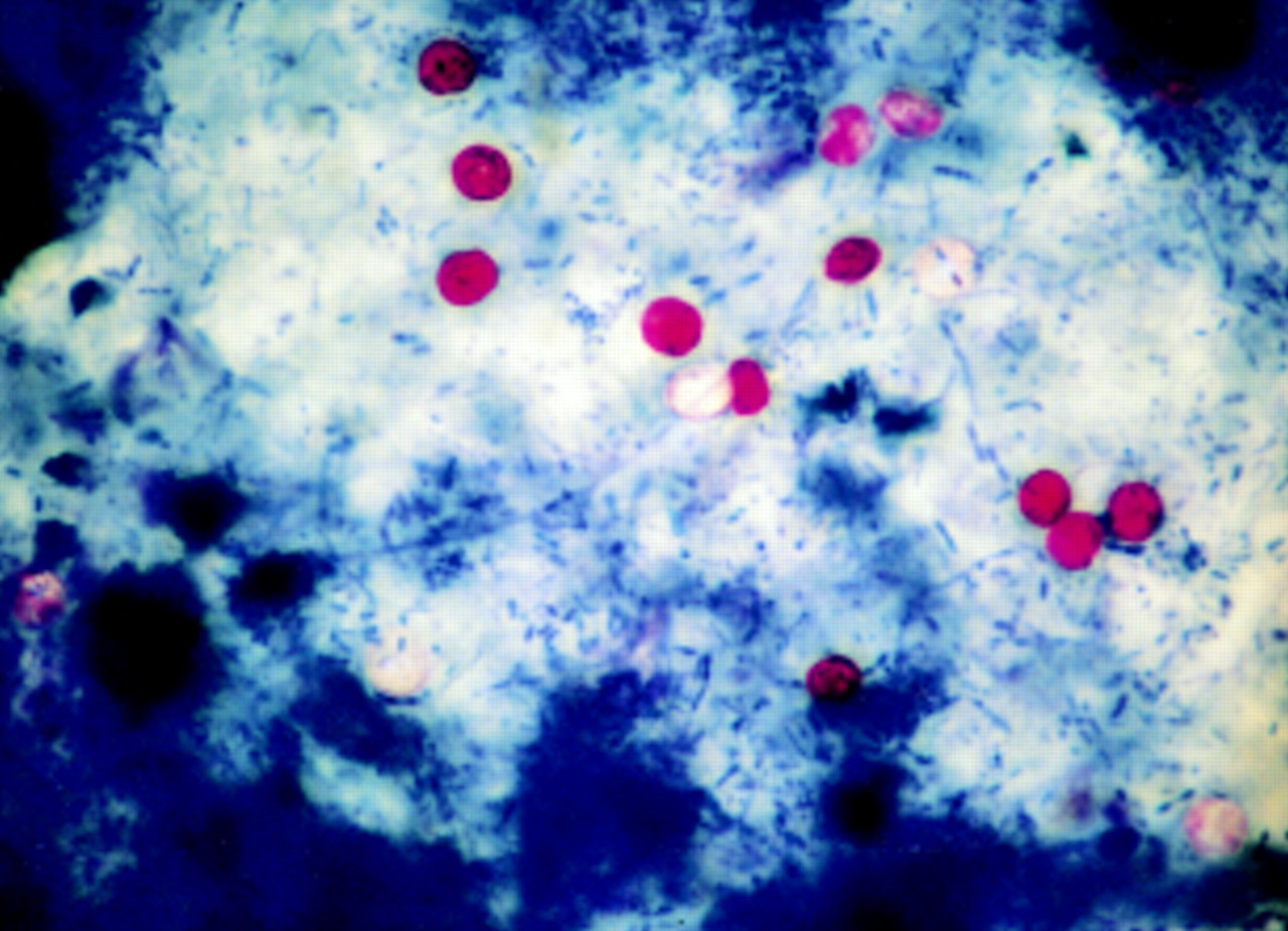 Cryptosporidium parvum